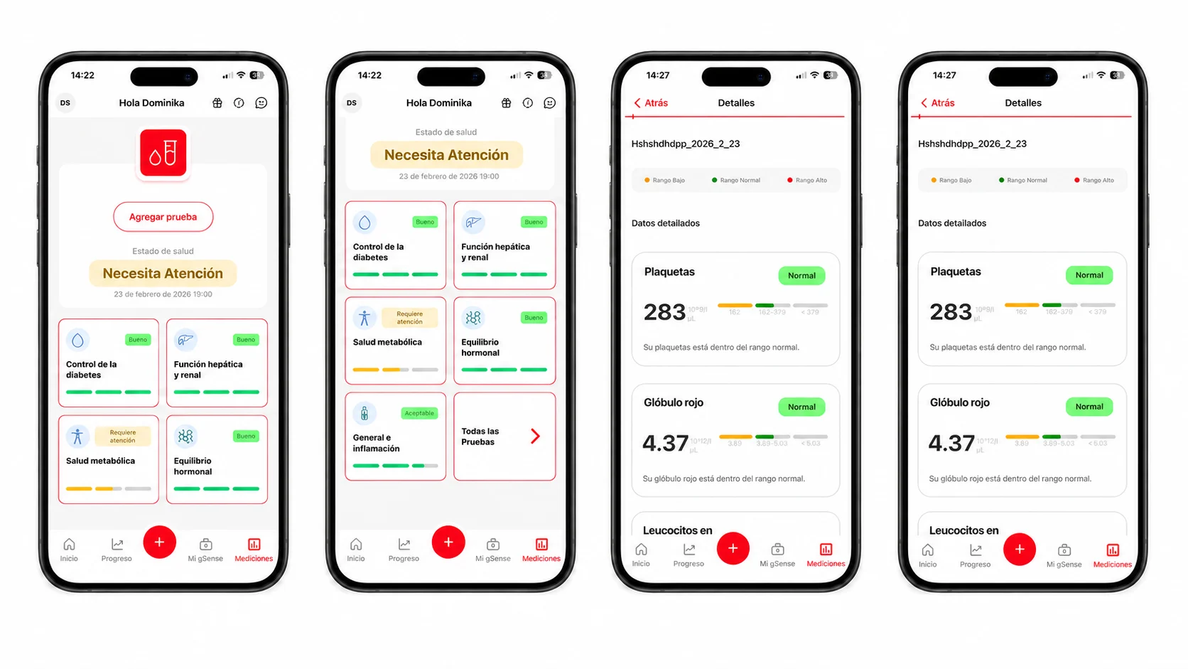 Lab AI de la app gSense: pantallas de mediciones y resultados de laboratorio
